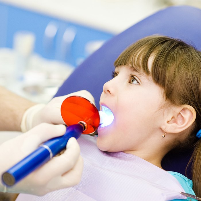Little girl receiving a tooth-colored filling