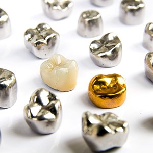 Several dental crowns made of various materials on a white surface