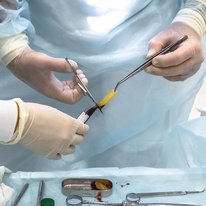 Lab worker handling PRP
