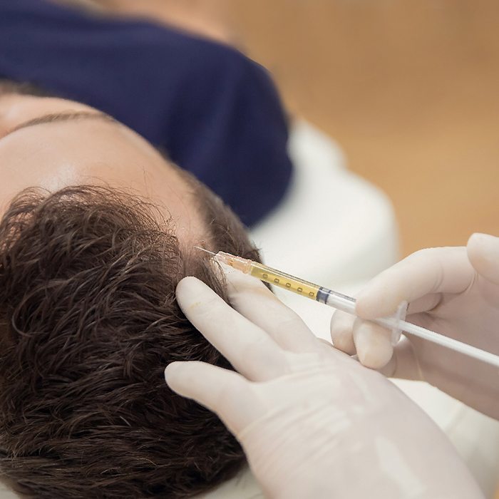Man getting PRP treatment