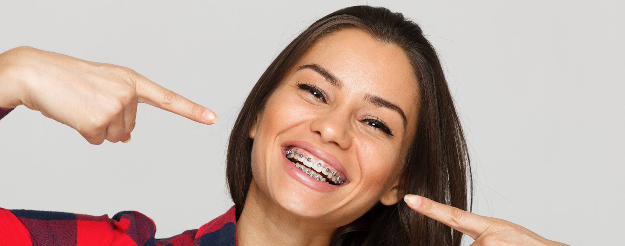 Woman in plaid shirt pointing to her smile with braces with both hands