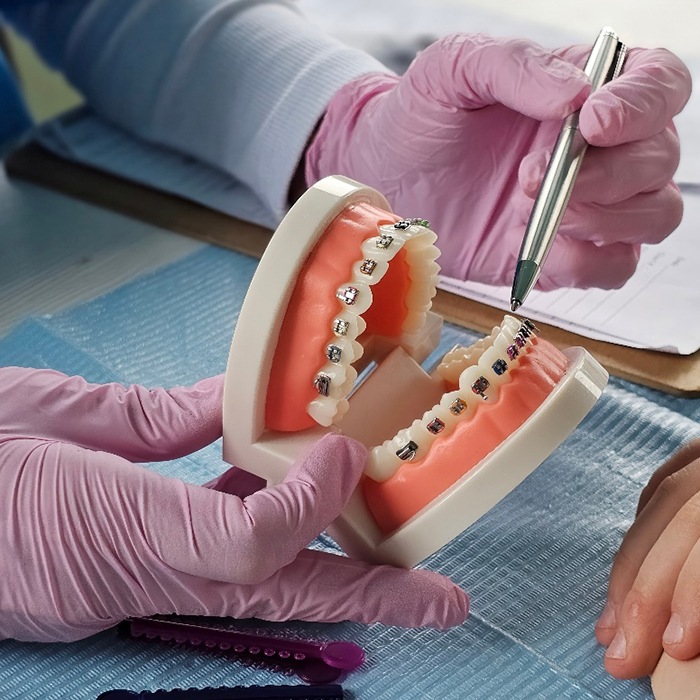 Hands of dentist showing sample braces to patient