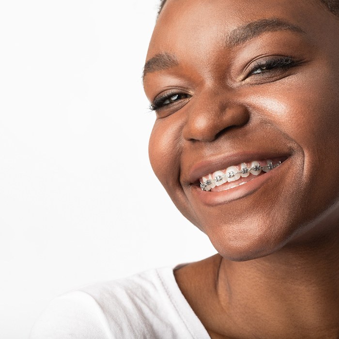 profile view of woman with braces smiling